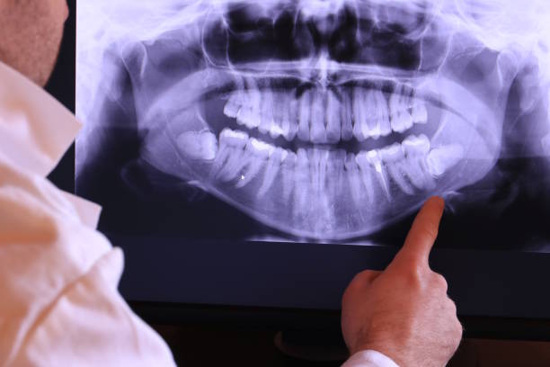 Best Holiday Emergency Dentist in Moody Af, GA