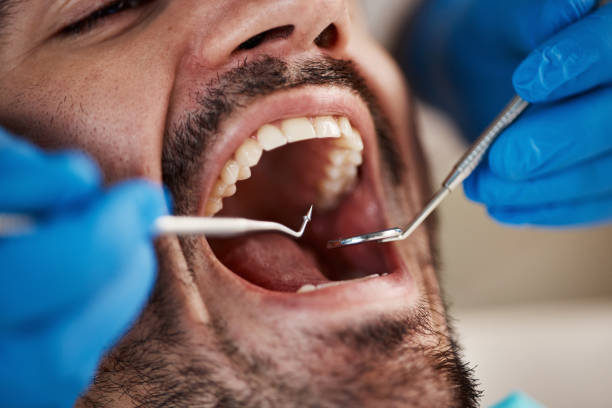 Best Pediatric Emergency Dentist in Moody Af, GA
