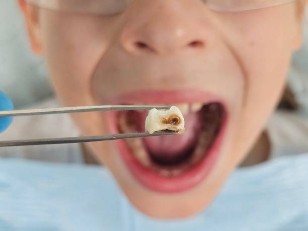 Best Urgent Dental Care for Toothache in Moody Af, GA