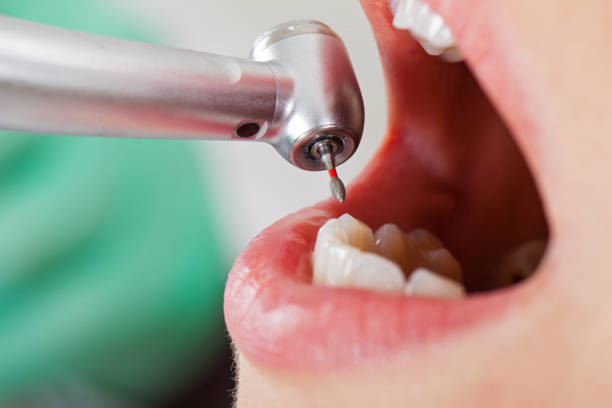 Best Broken or Cracked Tooth Emergency Dentist in Moody Af, GA